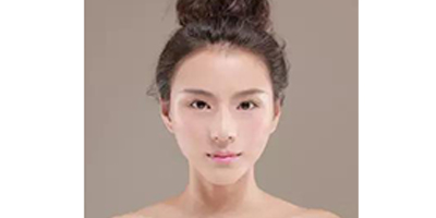 玻尿酸全臉填充術(shù)后