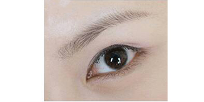 種植眉毛術(shù)后