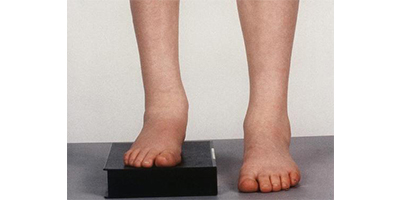 長(zhǎng)短腿矯正術(shù)前