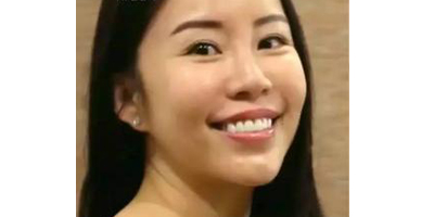 三文魚針術(shù)前