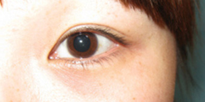 半永久紋眼線術前