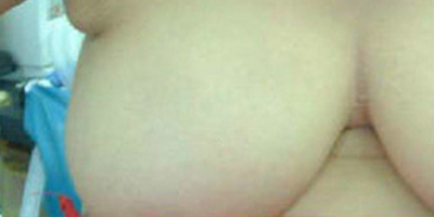 吸脂去副乳術前