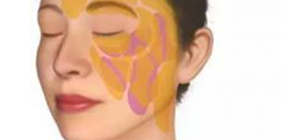 自體脂肪存儲術前