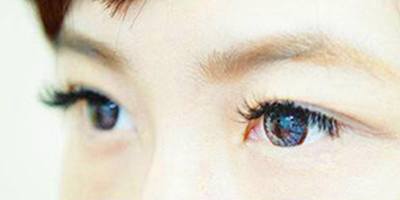 接睫毛術(shù)后