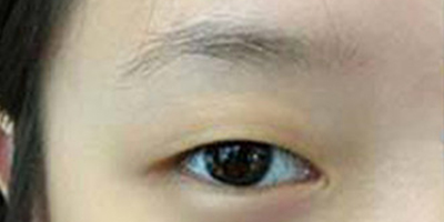 半永久紋眉術(shù)前