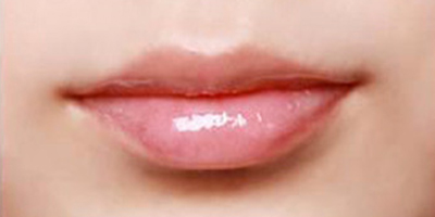 半永久紋唇術后