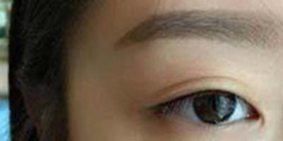 半永久紋眉術(shù)后