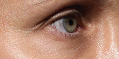 菲洛嘉術(shù)前