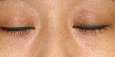 洗眼線術(shù)前