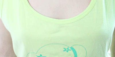 胸部假體取出術(shù)后