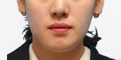 注射瘦臉術(shù)前