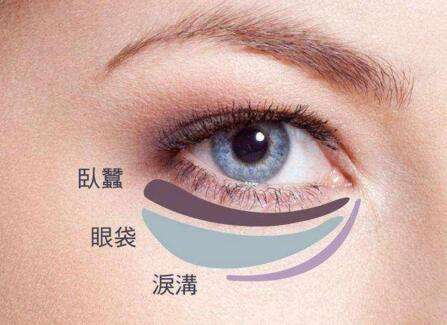 眼袋失敗修復要怎么處理？切眼袋需要多長時間恢復？