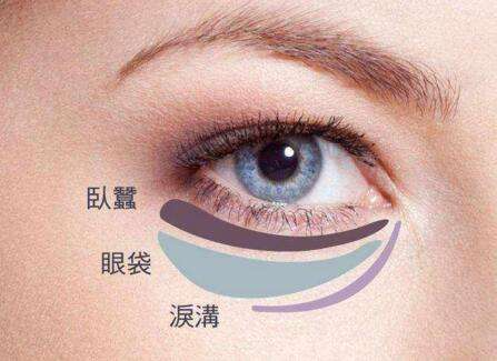 眼袋失敗修復(fù)要怎么處理？切眼袋需要多長(zhǎng)時(shí)間恢復(fù)？
