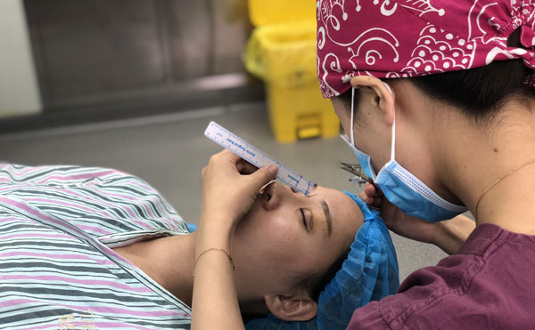 超體隆鼻怎么樣，能保持多久？超體隆鼻可能出現(xiàn)的副作用有哪些？