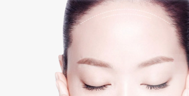 自體脂肪豐額頭效果怎么樣？自體脂肪豐額頭效果可以保持多久？