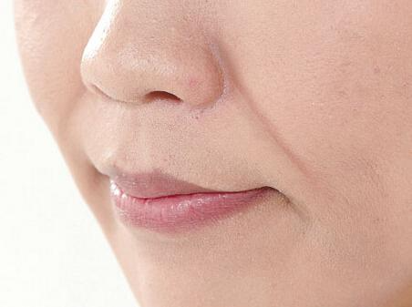 注射填充法令紋的方式有哪些？如何通過醫(yī)美手段祛法令紋？