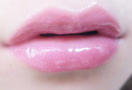 自體脂肪豐唇效果好嗎？自體脂肪豐唇大概多少錢？