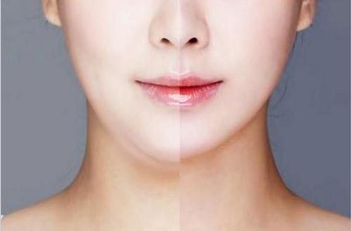 面部吸脂最好的辦法是什么？做一次面部吸脂多少錢(qián)？