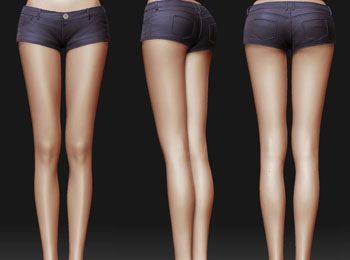 吸脂瘦小腿效果好不好？吸脂瘦小腿適用于那些人？