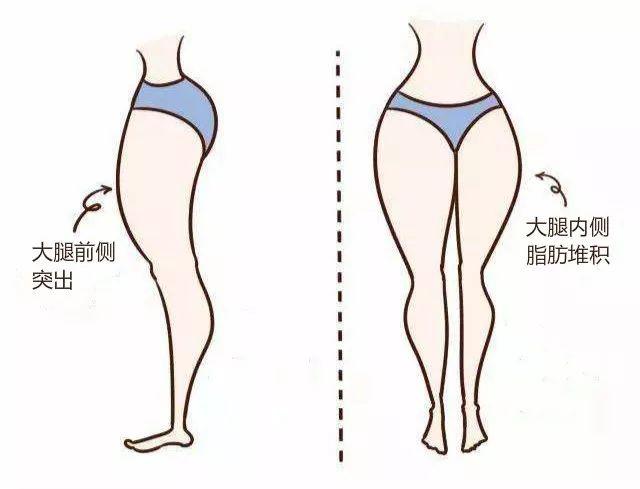 隔空溶脂瘦大腿有什么副作用 隔空溶脂瘦大腿如何護(hù)理