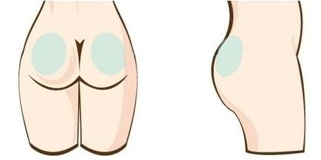 隔空溶脂瘦臀部多少錢(qián) 隔空溶脂瘦臀部術(shù)后效果怎么樣