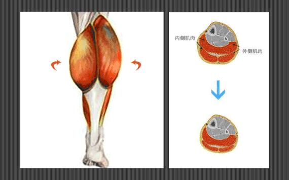 小腿肌肉阻斷術(shù)是什么？小腿神經(jīng)阻斷術(shù)的后遺癥有嗎？