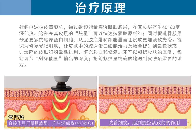  射頻緊膚的效果到底怎么樣呢？射頻緊膚多久做一次？