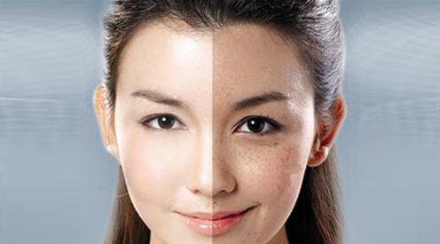 鐳射凈膚的原理功效 ？鐳射凈膚和m22是一種東西嗎？