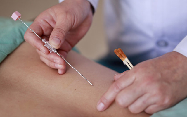 埋線減肥多少錢一次？埋線減肥多久才能有效果？