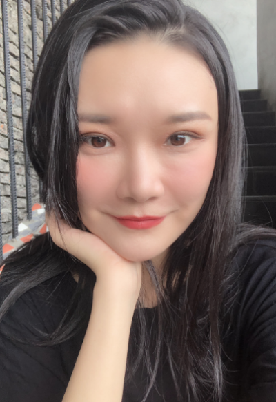  寧波尚美整形美容醫(yī)院做雙眼皮手術(shù)后半個(gè)月