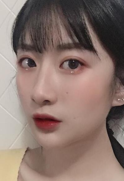 珠海陸達(dá)美容外科醫(yī)院做下頜角術(shù)后效果恢復(fù)的很好