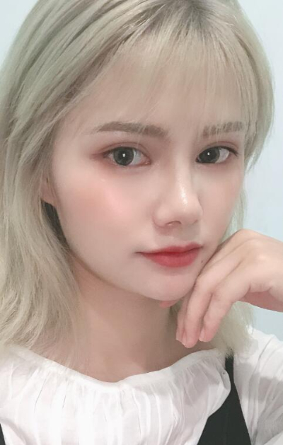 長春亞韓醫(yī)學(xué)美容醫(yī)院做面部吸脂手術(shù)后的臉部