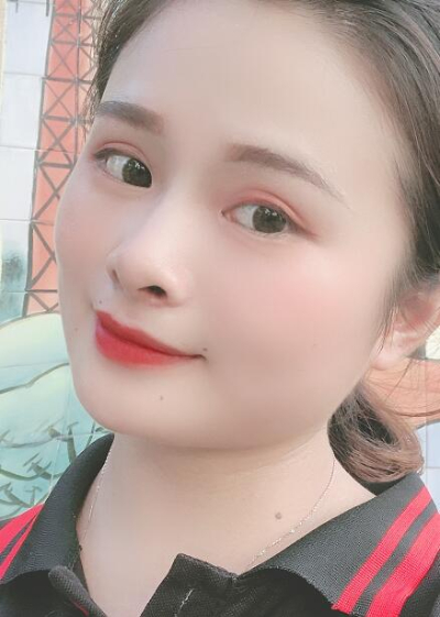 長(zhǎng)春中妍醫(yī)療美容醫(yī)院做雙眼皮手術(shù)后的最終效果