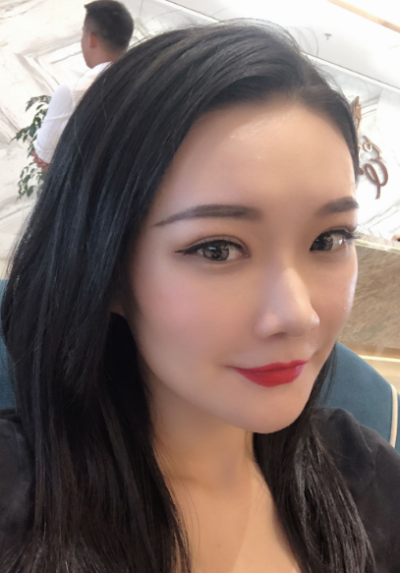 寧波尚美整形美容醫(yī)院齊強(qiáng)雙眼皮案例效果分享