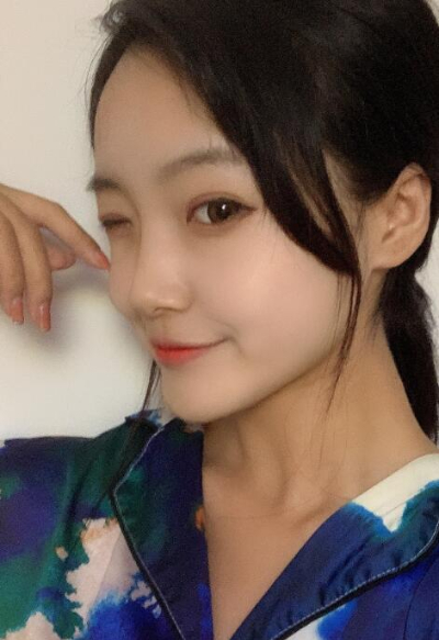 蘇州愛思特醫(yī)療美容醫(yī)院做隆鼻手術(shù)后的鼻子的日常