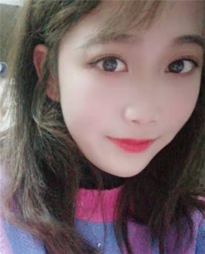 蘇州美貝爾美容醫(yī)院做面部吸脂手術(shù)后的效果