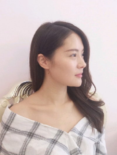  寧波尚美整形美容醫(yī)院做鼻綜合手術(shù)后復(fù)診情況