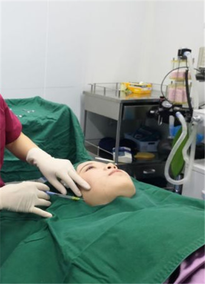 蘇州美貝爾美容醫(yī)院龔斌面部吸脂案例效果分享
