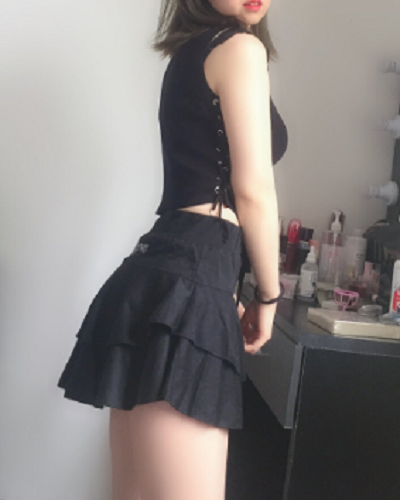 煙臺(tái)壹美整形美容醫(yī)院朱建瑩腰腹吸脂案例效果分享