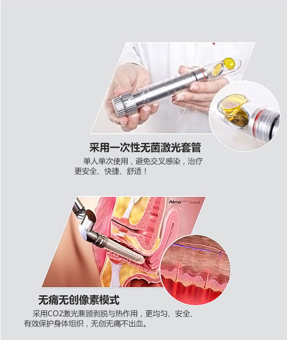 成都愛爾麗整形激光緊縮陰道怎么樣？激光緊縮陰道注意什么？