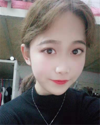 蘇州美貝爾美容醫(yī)院做面部吸脂術(shù)后的最終效果