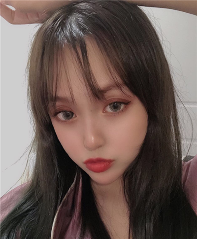 慈溪悅爾醫(yī)學美容醫(yī)院做雙眼皮術后基本消腫情況