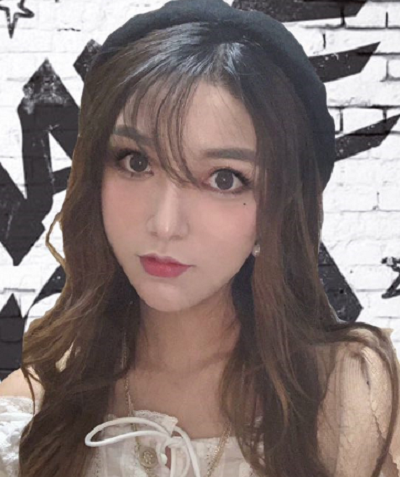 寧波尚美整形美容醫(yī)院齊強(qiáng)隆鼻案例效果分享