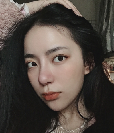 成都漢密爾頓美容醫(yī)院做鼻修手術(shù)后的恢復(fù)情況