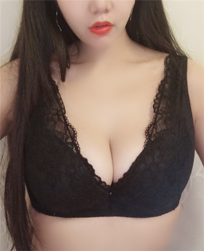 慈溪悅爾醫(yī)學(xué)美容醫(yī)院做隆胸手術(shù)后的第58天