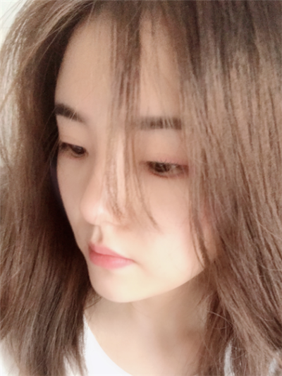 煙臺(tái)壹美整形美容醫(yī)院做隆鼻完成后的日常效果