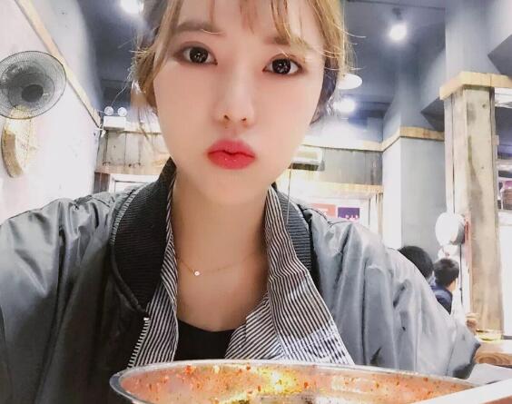 第四軍醫(yī)大學(xué)唐都醫(yī)院李望舟雙眼皮案例術(shù)后兩個(gè)月