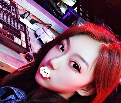 在上海伊美爾港華做假體隆鼻術后一個月效果