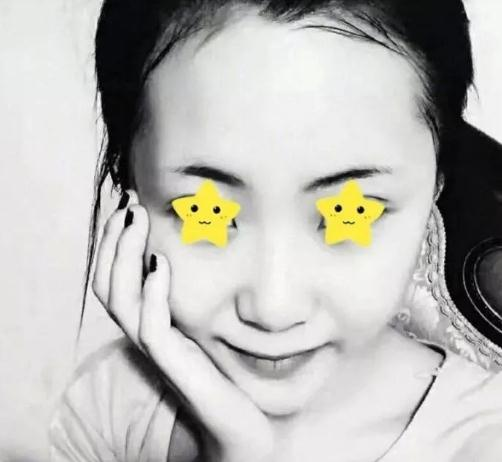 做綜合鼻，上海首爾麗格安建榮鼻綜合真人案例照片