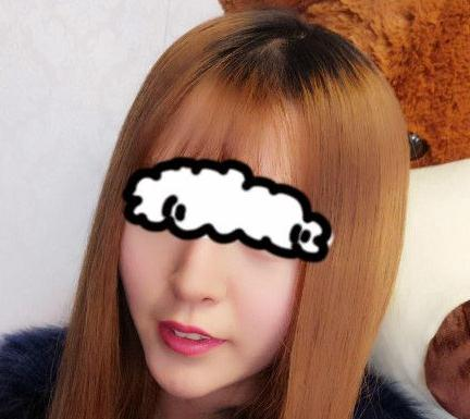 北京聯(lián)合麗格卓彥醫(yī)療趙瓊隆鼻失敗修復(fù)手術(shù)案例分享